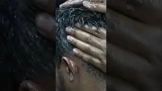 ASMR Scratching Head With Lots Of Oil #shorts