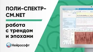 Работа с трендом и эпохами в программе Поли-Спектр-СМ.NET