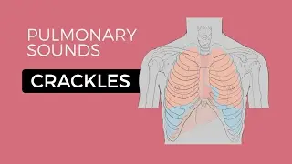 Crackles or Crepitations - Quick & Easy Overview (Easy Lung Sounds)