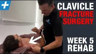 Clavicle Fracture ORIF Surgery - Week 5 REHAB