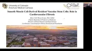 Pathological Cardiovascular Fibrosis | Mary Weiser-Evans, PhD