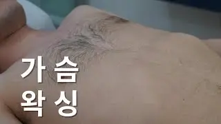 남자 가슴배 왁싱 짧게 보는 시술 영상