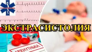 Экстрасистолия