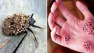 12 Most Painful Animal Stings You Can Experience