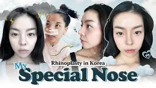 I got a new nose in Korea and I LOVE it! | Nana's rhinoplasty at Braun PART 1 💖