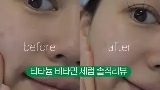 미백케어 | 미백세럼 추천 | 비타민c 세럼이라고 다 같은게 아니야! | 티타늄 비타민 세럼, Ti72 티타늄 C 세럼, Ti72티타늄 솔루션