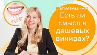 Композитные виниры | Стоимость, показания и метод установки
