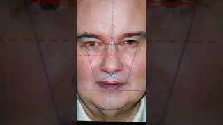Eamonn Holmes & Ruth Langsford Golden Ratio analysis by facial cosmetic surgeon 