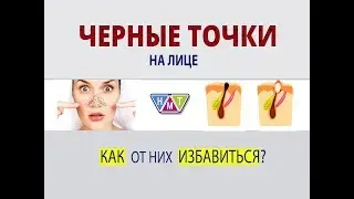 ЧЕРНЫЕ точки на лице
