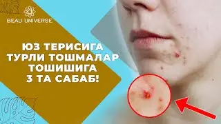 ЮЗ ТЕРИСИДА УГРИ ТОШМАЛАР ТОШИШИГА 3 ТА АСОСИЙ САБАБ!
