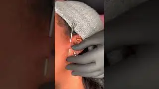 Surface Tragus Piercing