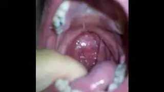 My fingers touching my throat