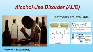 Treatments for Alcohol use disorder (AUD)
