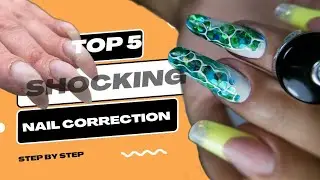 SHOCKING VIDEO. nail correction transformation 💅