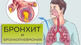 BRONCHITIS and BRONCHOPNEUMONIA