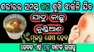ଯାଦୁ,କାଛୁ,କୁଣ୍ଡିଆଣ ଏବଂ ଖସ ଶୁଖି ଝାଉଁଳି ଯିବ | Home Remedies to Cure Fungal Infection and Sweat Rashes