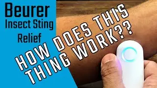 What exactly does this do?? Testing the Beurer BR60 Insect Sting and Bite Relief