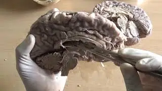 Brain 🧠 overview |Useful info|#youtube #educationalvideo #informationtechnology #brain #medical