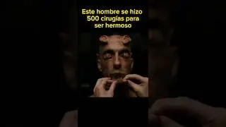 Se hizo 500 CIRUGIAS para ser HERMOSO #cortos #resumenpeliculas #pelicula