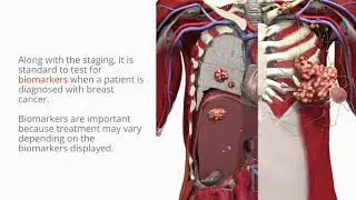 Disease and Conditions: What is Breast Cancer?
