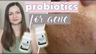 Probiotics For Acne & Clear Skin - Supplements for Breakouts - Clear Skin Diet