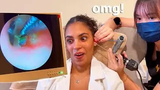 ASMR: Deep Ear Cleaning with Tweezers to Remove Earwax!