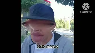 Cheb 3azuzu - 89KG HMOUM ( Lyrical Video )