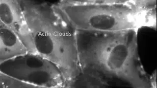 Endothelial microvascular cells