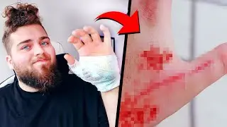 FUI MORDIDO POR UM CÃO...
