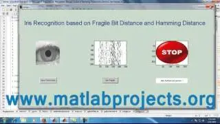 Iris Recognition Image Processing Matlab Projects