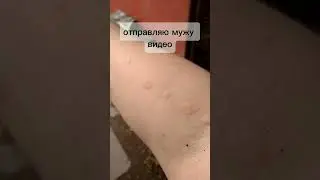 мой рыцарь)  спасибо @waterfork за борьбу с крапивой на камеру) #городскиевдеревне