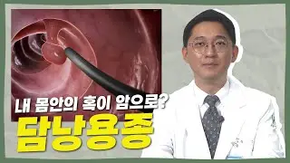 아시아인종은 담낭암 발병율이 서양의 5배나 높습니다