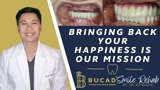 BRINGING BACK YOUR HAPPINESS IS OUR MISSION 3D PRINTED DENTURES AND BRIDGE WITH 6 DENTAL IMPLANTS