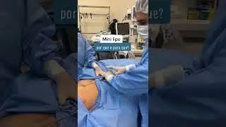 Mini lipo - Por que e para que?
