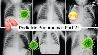 Pneumonia in Children (2/ 2): Clinical assessment & treatment