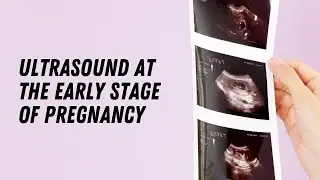 Ultrasound at the early stage of pregnancy #doctorberezovska #olenaberezovska #pregnancy #ultrasound