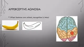 13 Object Recognition