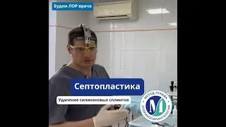 Удаление силиконовых сплинтов после септопластики.