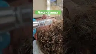 Чистка лица #косметолог #красота #прыщи #поры