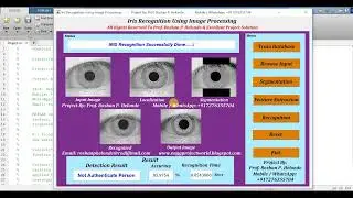 Matlab Code for Iris Recognition Using Image Processing Matlab Project Code Final Year Project