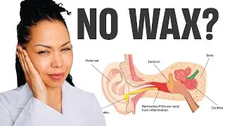 Your Ears Feel Clogged — But There’s No Wax? Here’s Why