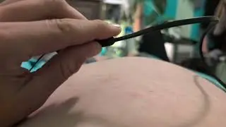 Water Balloon Belly