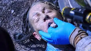 They Dug 2kg of Cement Out of Her Mouth?!💀【Collection】
