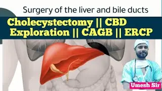 cholecystectomy || cbd exploration || cagb || ERCP || gastro surgery || medical || hospital