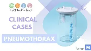 Pneumothorax Clinical Case