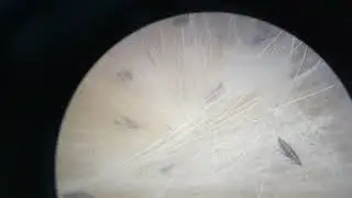 Cat flea - Kedi piresi