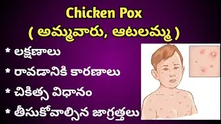 Chicken Pox (Amma Varu, Atalamma) causes, Symptoms and Treatment in Telugu