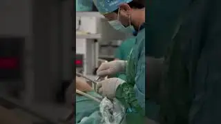 Reasons to Have Gastric Sleeve Surgery in Istanbul│Medproper