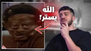 جدري القرود مخيف