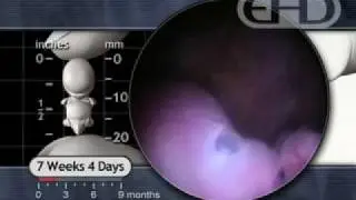 Eyes and Hands: 7 1/2 Weeks Pregnant